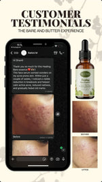 Customer testimonial - Healing Bare Essence