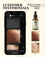 Customer results - Healing Bare Essence