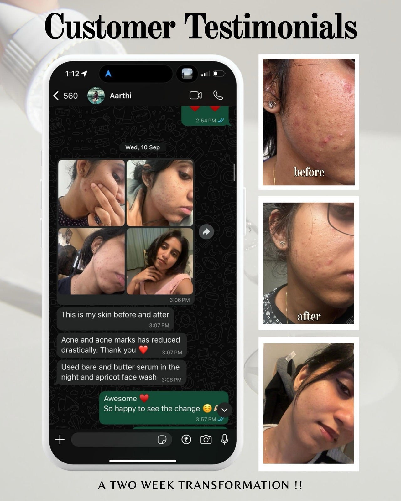 Customer testimonial — a two-week skin transformation